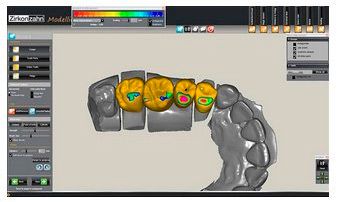 Clínica Dental Dr. Rafael Menéndez imagen en 3D