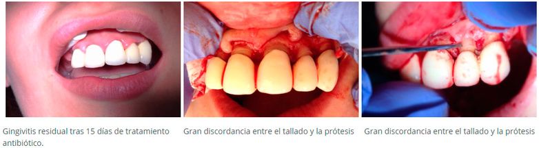 Clínica Dental Dr. Rafael Menéndez ejemplos de patologías