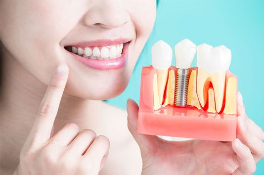 La periimplantitis es un trastorno dental que afecta a muchas personas sin saberlo. Descubre lo que es en este artículo. 