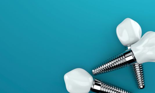 rehabilitación aconsejada para implantes dentales