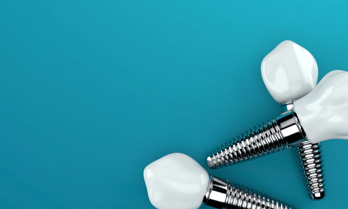 rehabilitación aconsejada para implantes dentales